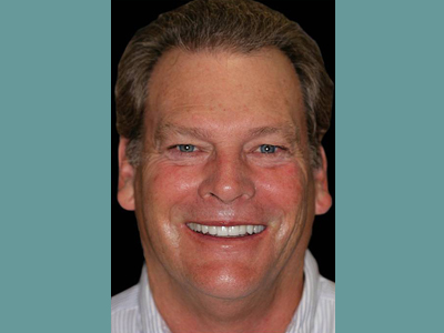 The image is a headshot of an older man with light skin, smiling at the camera. He has gray hair and appears to be wearing a suit jacket. There are no visible texts or logos in the image.