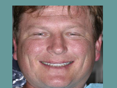 A smiling man with a light complexion, wearing a white shirt.