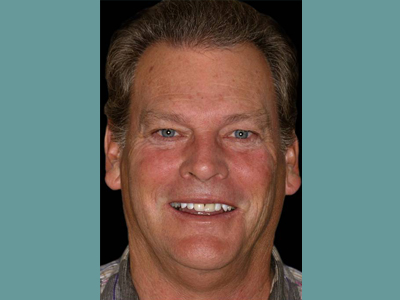 The image displays a man with a smiling expression, wearing glasses and a dark shirt. He has short hair and appears to be middle-aged or older.