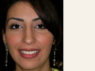 A woman with a smile, wearing earrings and a yellow top.