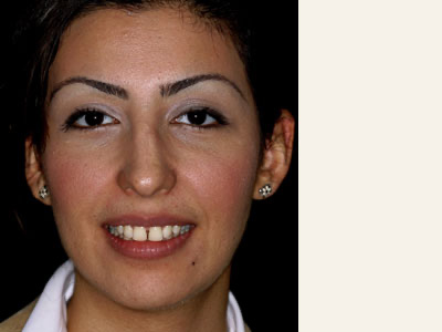 The image displays a woman with a neutral expression, wearing a light-colored top and dark trousers, against a plain background.