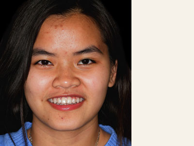 The image is a close-up photograph of an individual, likely taken for identification purposes. The person is smiling and appears to be a young adult with light skin. They have dark hair and are wearing what seems to be a white top. There's a noticeable mole on the right side of their face.