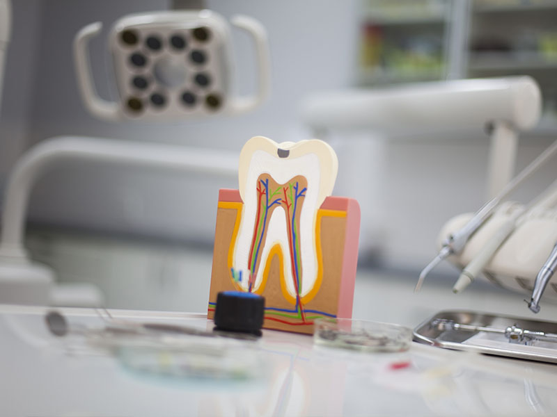 The image shows a dental model with an open mouth, placed on a stand in front of a dental chair and equipment, with a focus on the model's teeth and gums.