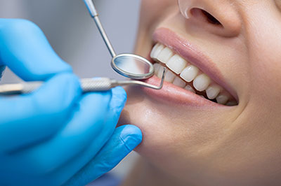 A dental professional performing a teeth cleaning procedure on a patient, with the patient s mouth open and the dental professional using a dental pick.