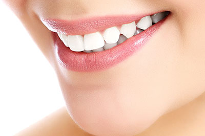 Image  Close-up of a person s smiling face, showcasing teeth whitening results with a focus on the brightness and cleanliness of their teeth.