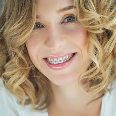 A woman with a radiant smile, wearing braces and sporting blonde curly hair.